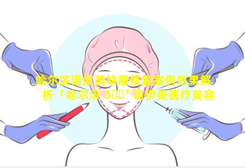 哈尔滨诺依美缺眉修复案例效果解析「哈尔滨 🌳 诺伊美医疗美容 🐞 门诊部」